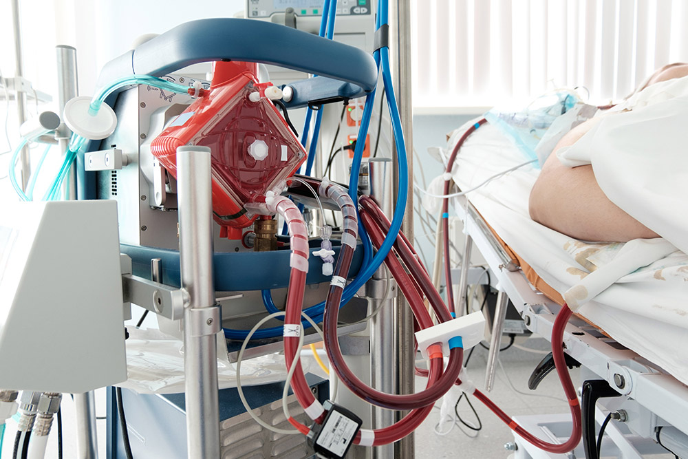 All About ECMO | American Lung Association