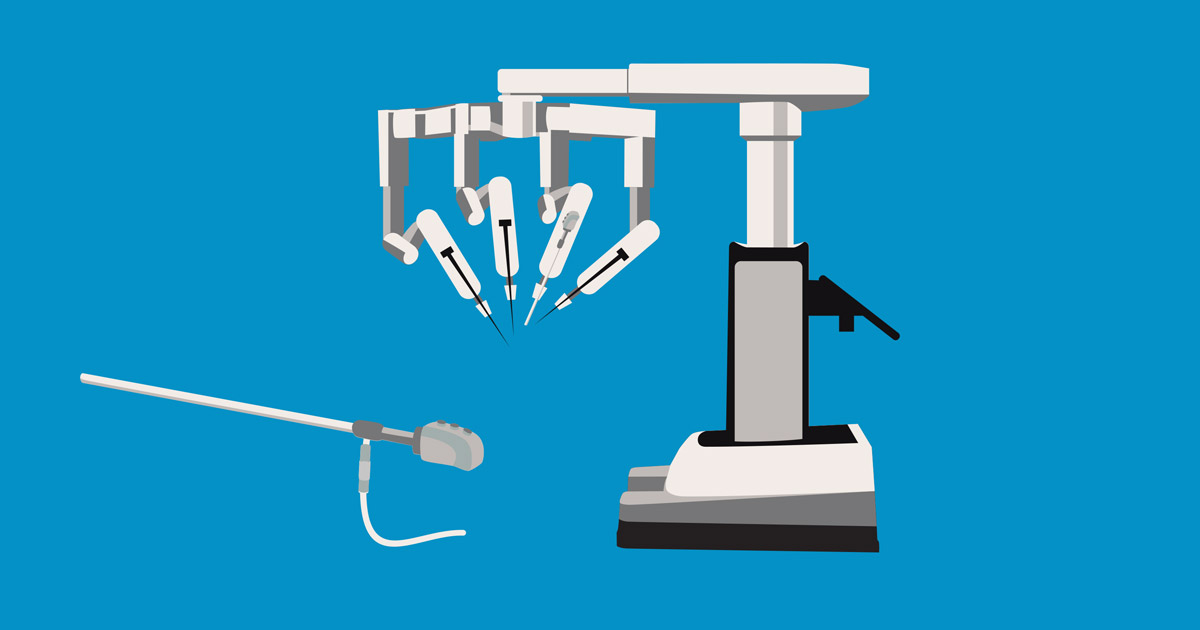 Minimally invasive thoracic surgery lung cancer