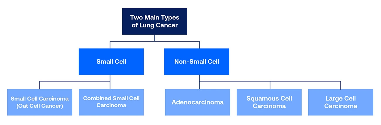 Large Cell Lung Carcinoma: Symptoms, Treatment, and More